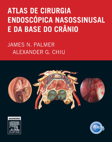 Atlas de Cirurgia Endoscópica Nasossinusal e da Base do Crânio 1ED