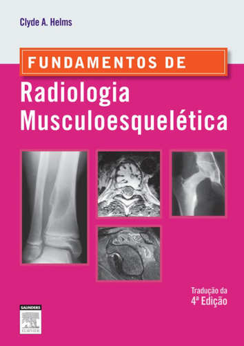 Fundamentos de Radiologia Musculoesquelética 4ED