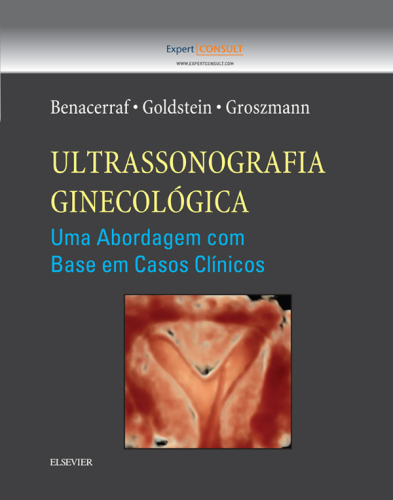 Ultrassonografia Ginecológica : Uma Abordagem com Base em Casos Clínicos