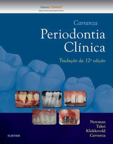 Carranza Periodontia Clínica 12ED