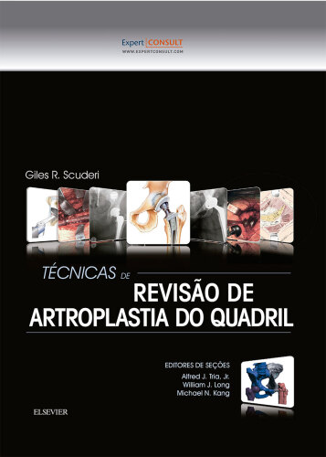 Técnicas de Revisão de Artroplastia do Quadril 1ED