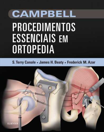 CAMPBELL Procedimentos Essenciais em Ortopedia 1ED