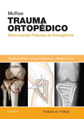 McRae Trauma Ortopédico 1ED: Gerenciando Fraturas de Emergência