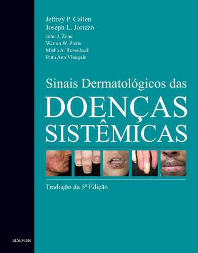 Sinais Dermatológicos das Doenças Sistêmicas 5ED