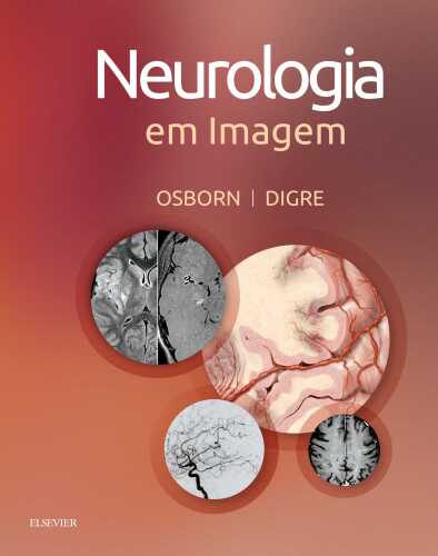 Neurologia em Imagem 1ED