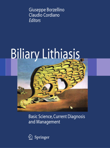 Biliary Lithiasis: Basic Science, Current Diagnosis and Management