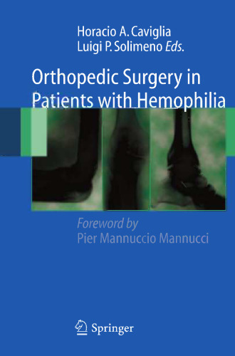 Orthopedic Surgery in Patients with Hemophilia