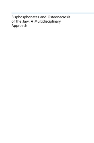 Bisphosphonates and Osteonecrosis of the Jaw: A Multidisciplinary Approach
