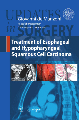 Treatment of Esophageal and Hypopharyngeal Squamous Cell Carcinoma