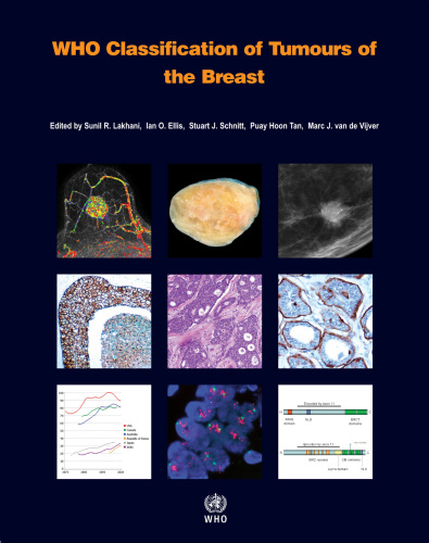 WHO classification of tumours of the breast