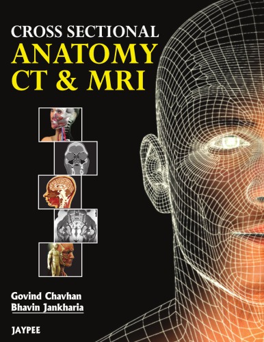 Cross Sectional Anatomy CT and MRI