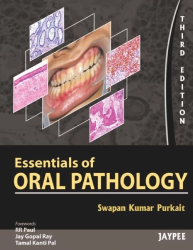 Essentials of oral pathology