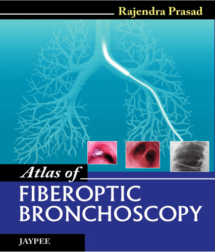Atlas of Fiberoptic Bronchoscopy