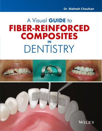 A Visual Guide to Fiber - Reinforced Composites in Dentistry