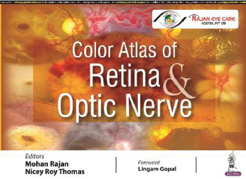 Color Atlas of Retina and Optic Nerve