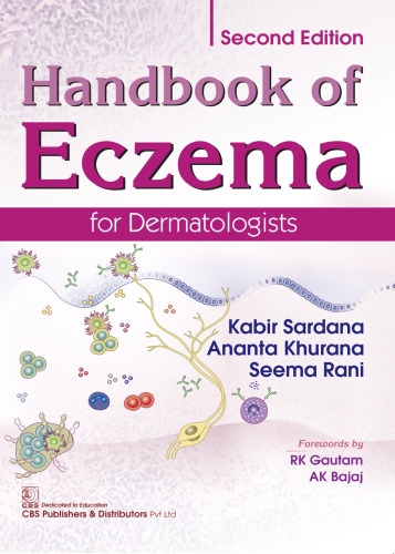 Handbook of Eczema for Dermatologist, 2e