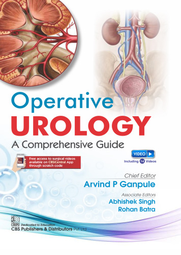 Operative Urology Comprehensive Guide