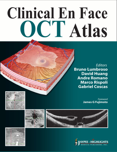 Clinical en Face OCT Atlas