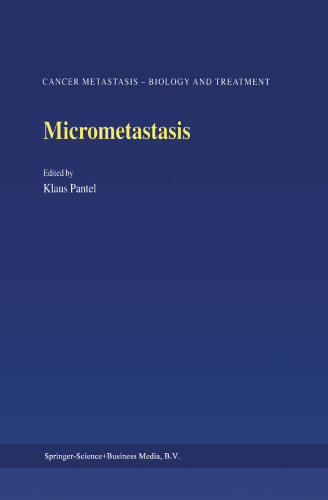 Micrometastasis