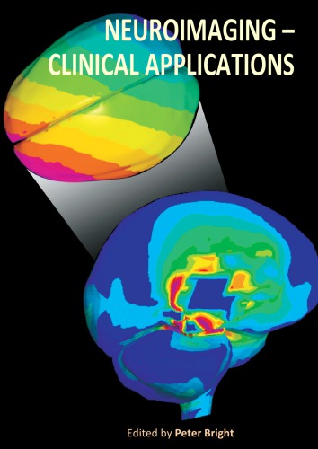 Neuroimaging - Clinical Applications