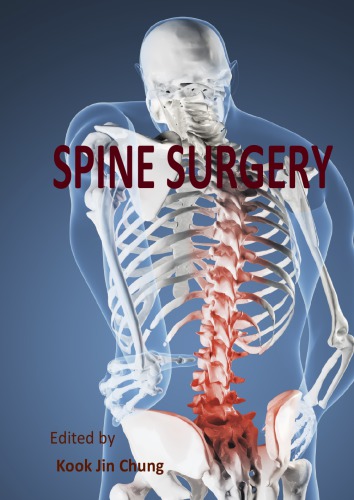 Spine Surgery