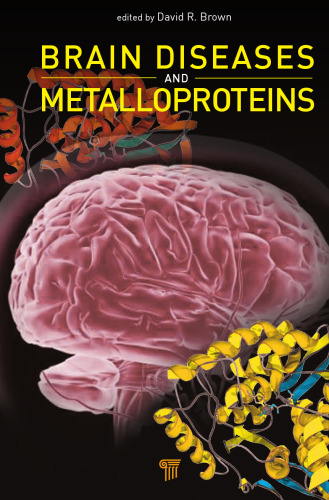 Brain diseases and metalloproteins