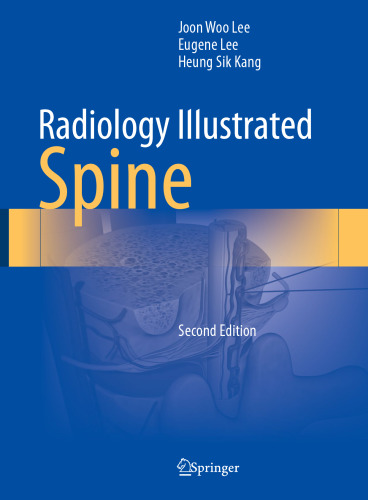 Radiology Illustrated-Spine, 2e (Dec 24, 2023)_(9819966116)_(Springer)