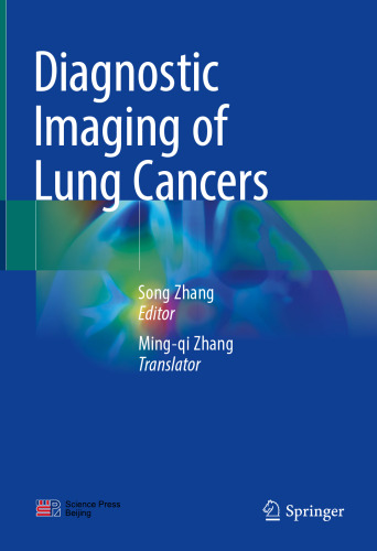 Diagnostic Imaging of Lung Cancers