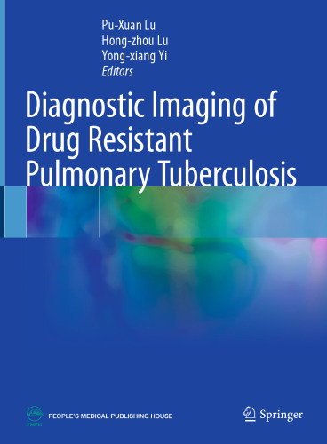 Diagnostic Imaging of Drug Resistant Pulmonary Tuberculosis (May 22, 2024)_(981998338X)_(Springer).pdf