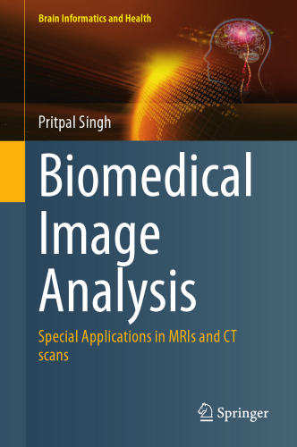 Biomedical Image Analysis: Special Applications in MRIs and CT scans