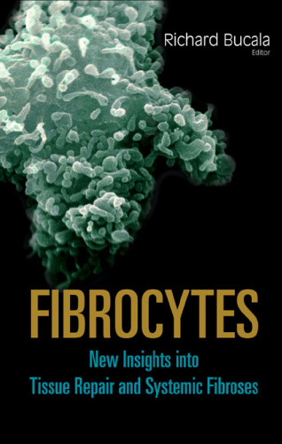 Fibrocytes: New Insights into Tissue Repair And Systemic Fibrosis