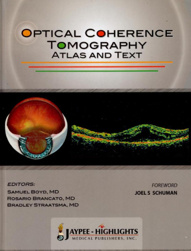 Optical Coherence Tomography—Atlas and Text