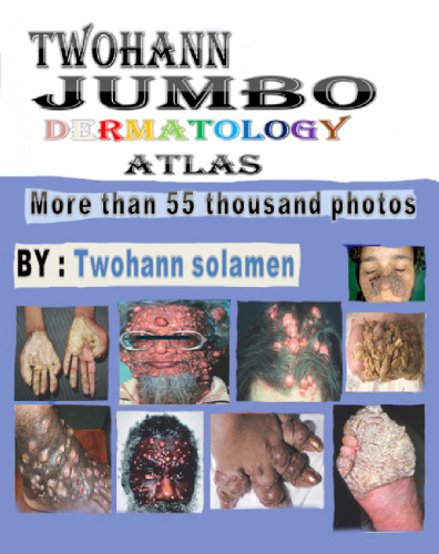 TWOhann jumbo dermatology atlas