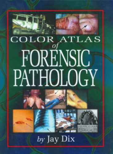Color.Atlas.of.Forensic.Pathology.eBook-EEn