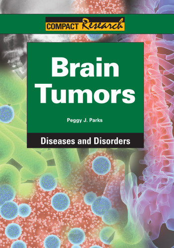 Brain Tumors