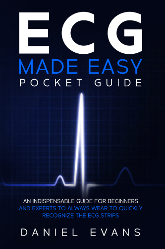ECG Made Easy Pocket Guide
