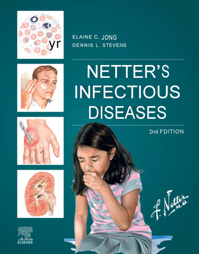 Netter's Infectious Diseases, 2e (Apr 28, 2021)_(0323711596)_(Elsevier).pdf