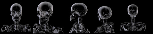 Body Turnarounds