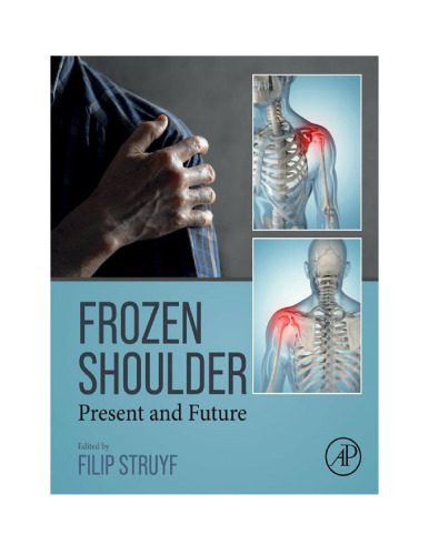 Frozen Shoulder - Present and Future