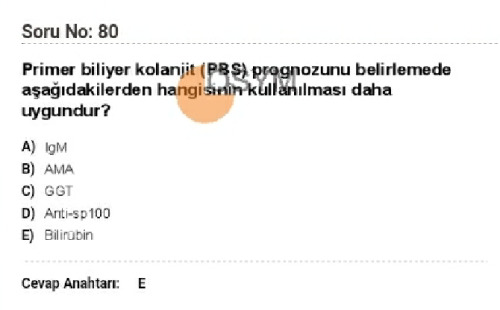 Dahiliye YDUS 2017 Soruları