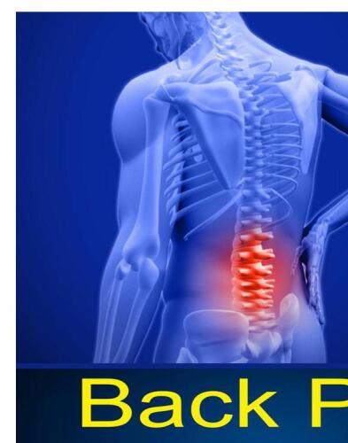 Back Pain: The Complete Guide to Healing Your Back Pain Without Surgery