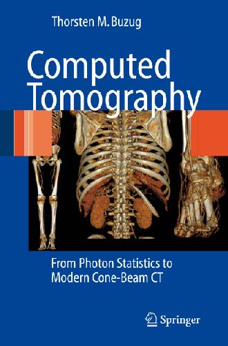 Computer Tomography - From Photon Statistics to Modern Cone-Beam CT