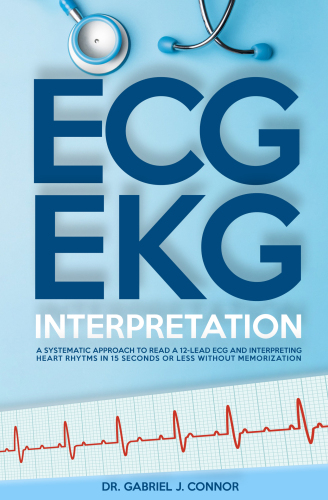 ECG / EKG Interpretation: A Systematic Approach to Read a 12-Lead ECG