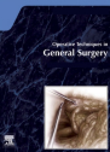Management of Intraoperative Complications