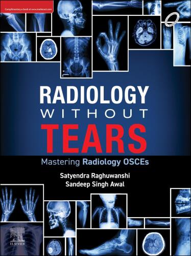 Radiology Without Tears - Mastering Radiology OSCEs (Aug 7, 2024)_(B0DDY6WXFJ)_(Elsevier India).rar