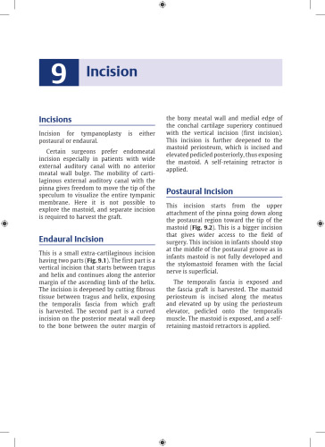 An Approach to Successful Tympanoplasty