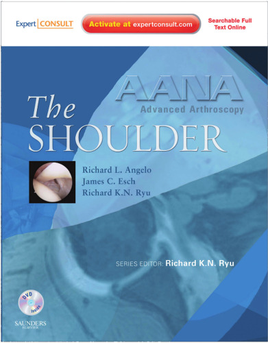 AANA Advanced Arthroscopy. The Shoulder