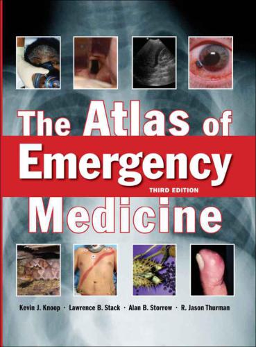 The Atlas of Emergency Medicine