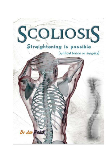 Scoliosis - straightening is possible
